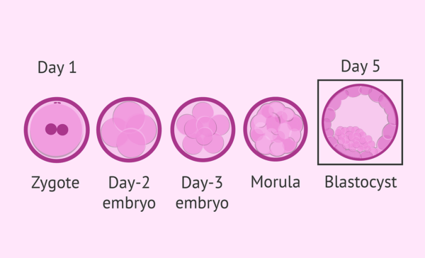 Blastocyst Culture Sneh Hospital