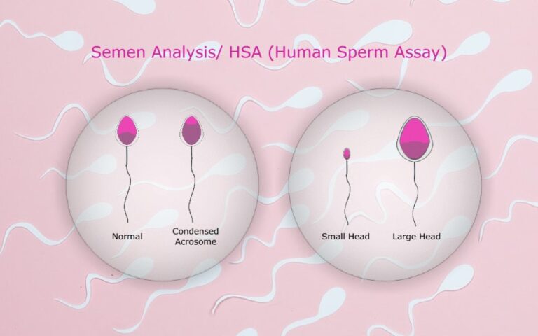 Hsa Test For Male To Checkup Male Fertility Human Sperm Assay Test